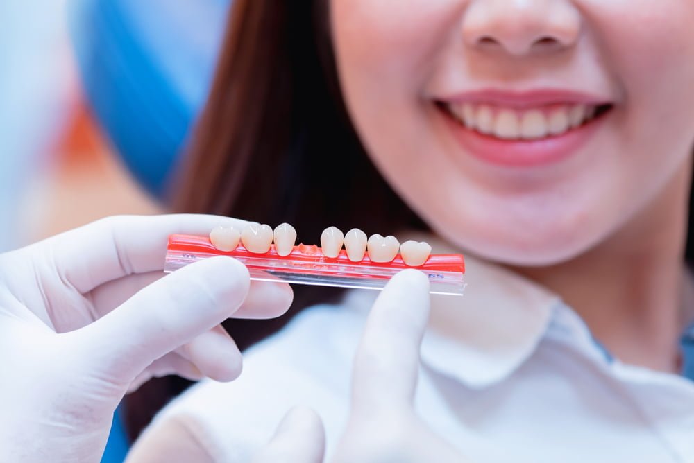 Dentist holding a model of dental crowns - Dental Crown in Georgetown Dentist holding a model of dental crowns - Dental Crown in Georgetown