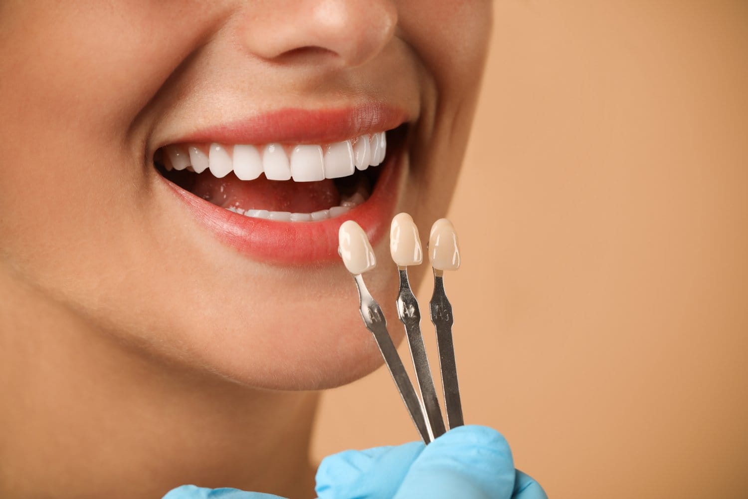 What is a Dental Crown? Understanding the Types and Conditions Treated