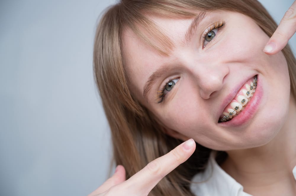 How do braces work? Your Complete Guide to Orthodontic Treatment